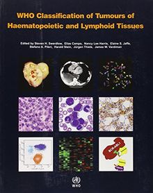 Who Classification of Tumours of Haematopoietic and Lymphoid Tissue