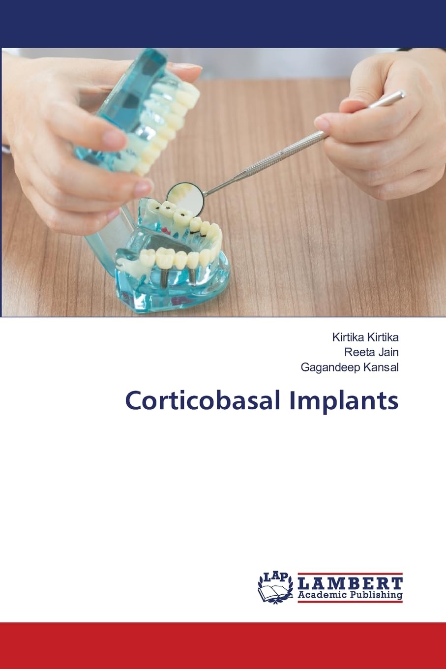 Corticobasal Implants: DE