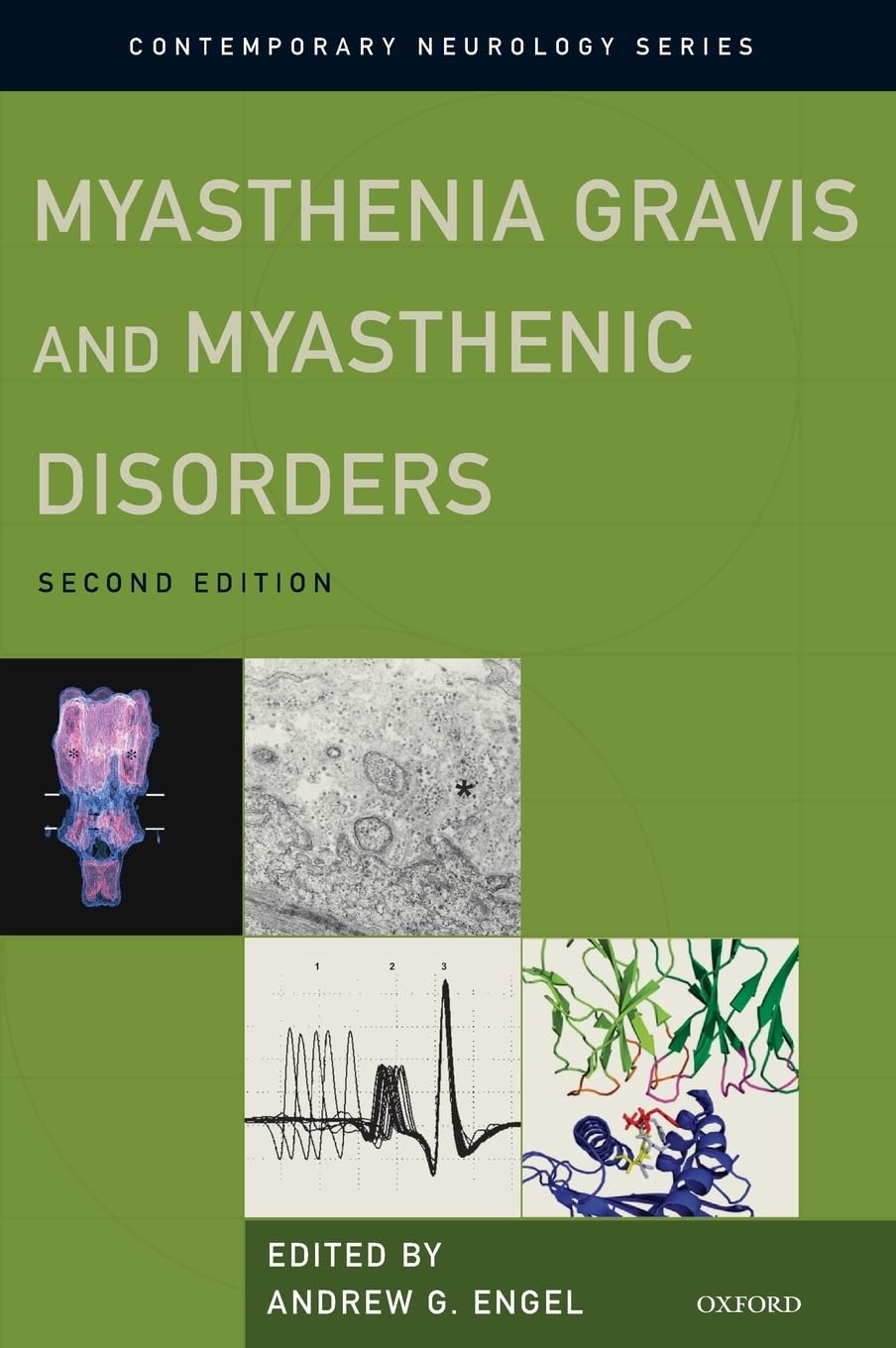 Myasthenia Gravis and Myasthenic Disorders (Revised) (Contemporary Neurology, Band 81)