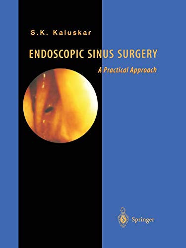 Endoscopic Sinus Surgery: A Practical Approach