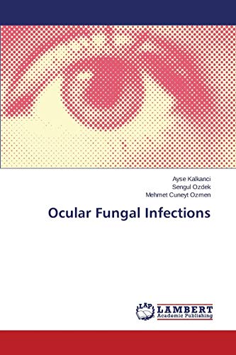 Ocular Fungal Infections