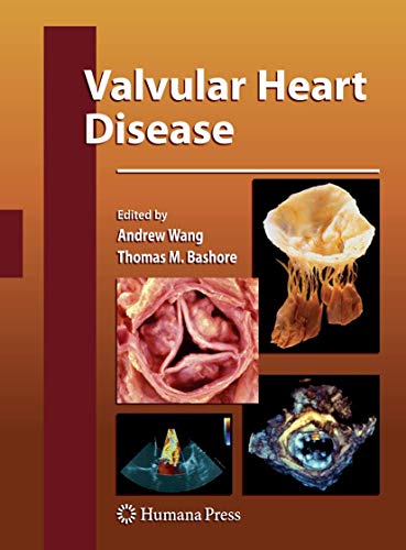 Valvular Heart Disease (Contemporary Cardiology)