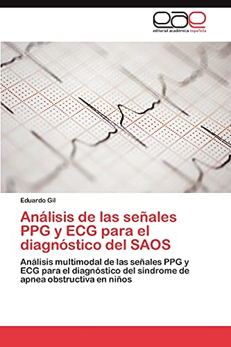 Análisis de las señales PPG y ECG para el diagnóstico del SAOS: Análisis multimodal de las señales PPG y ECG para el diagnóstico del síndrome de apnea obstructiva en niños