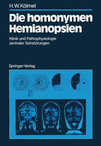 Die homonymen Hemianopsien: Klinik und Pathophysiologie zentraler Sehstörungen