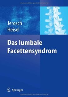 Das lumbale Facettensyndrom