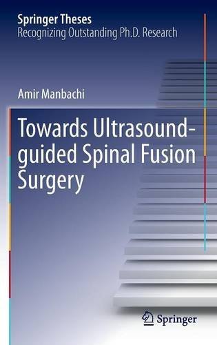 Towards Ultrasound-guided Spinal Fusion Surgery (Springer Theses)