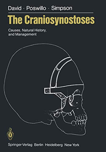 The Craniosynostoses: Causes, Natural History, And Management