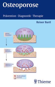 Osteoporose. Prävention-Diagnostik-Therapie