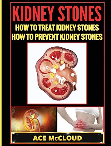 Ace Mccloud Kidney Stones, How To Treat Kidney Stones, How To Prevent Kidney Stones (Kidney Stone Treatment & Prevention Guide With All)