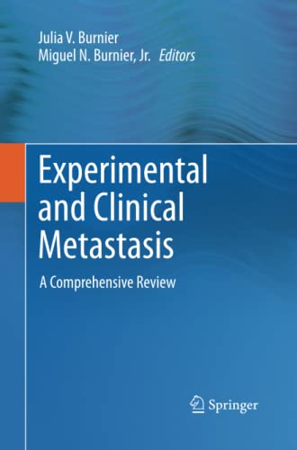 Experimental and Clinical Metastasis: A Comprehensive Review