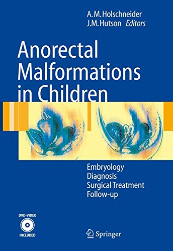 Anorectal Malformations in Children: Embryology, Diagnosis, Surgical Treatment, Follow-up