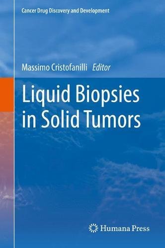 Liquid Biopsies in Solid Tumors (Cancer Drug Discovery and Development)