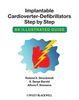 Implantable Cardioverter-Defibrillators Step by Step: An Illustrated Guide
