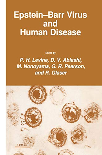 Epstein-Barr Virus and Human Disease (Experimental Biology and Medicine, 15, Band 15)