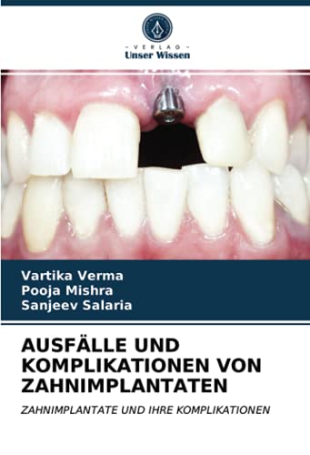 AUSFÄLLE UND KOMPLIKATIONEN VON ZAHNIMPLANTATEN: ZAHNIMPLANTATE UND IHRE KOMPLIKATIONEN