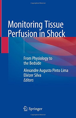 Monitoring Tissue Perfusion in Shock: From Physiology to the Bedside