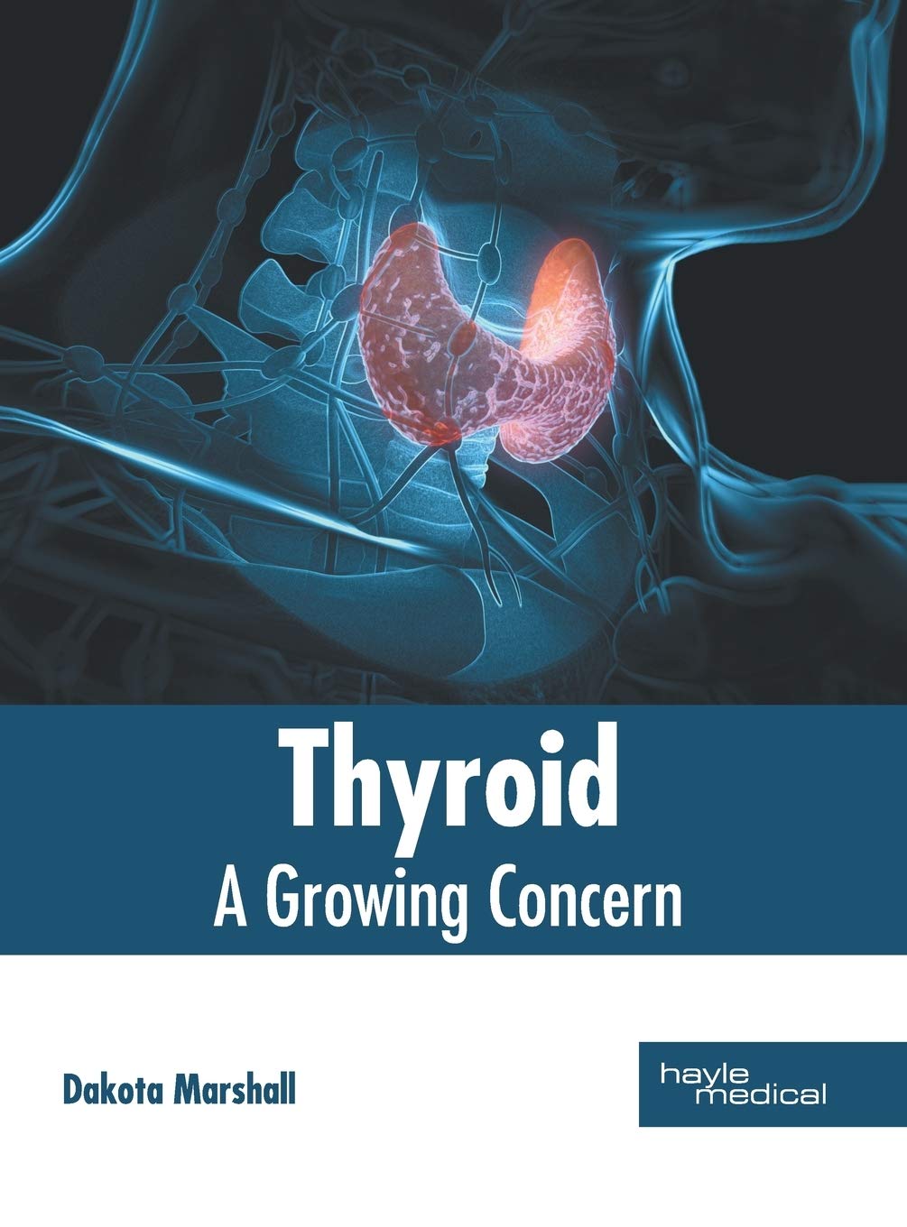 Thyroid: A Growing concern