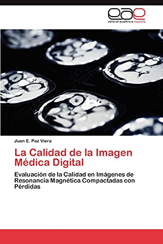 La Calidad de la Imagen Médica Digital: Evaluación de la Calidad en Imágenes de Resonancia Magnética Compactadas con Pérdidas