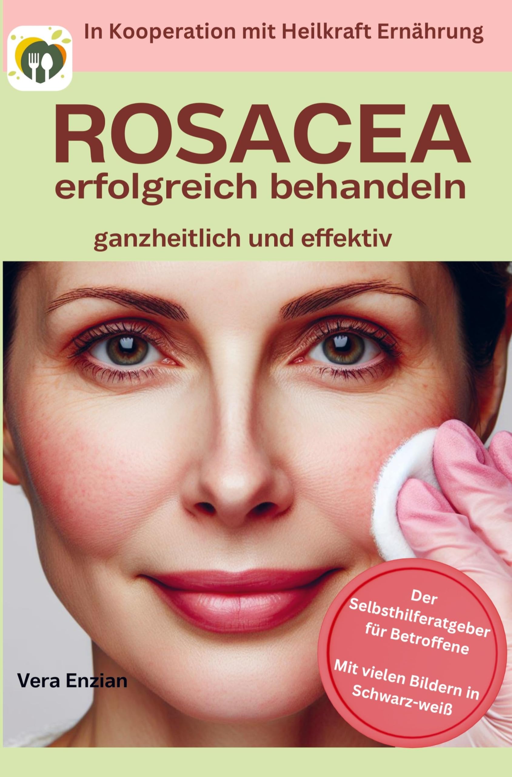 Rosacea erfolgreich behandeln - ganzheitlich und effektiv Der Selbsthilferatgeber für Betroffene mit Tipps die wirklich funktionieren - Vera Enzian Kartoniert (TB)
