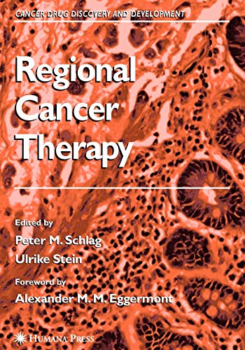 Regional Cancer Therapy (Cancer Drug Discovery and Development)