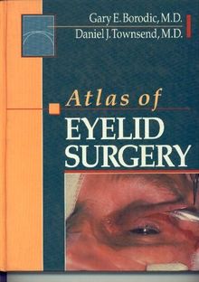 Atlas of Eyelid Surgery