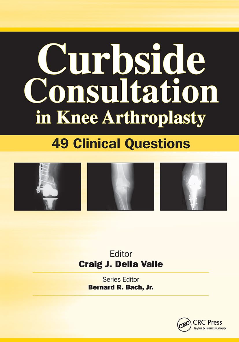 Curbside Consultation in Knee Arthroplasty: 49 Clinical Questions (Curbside Consultation in Orthopedics)