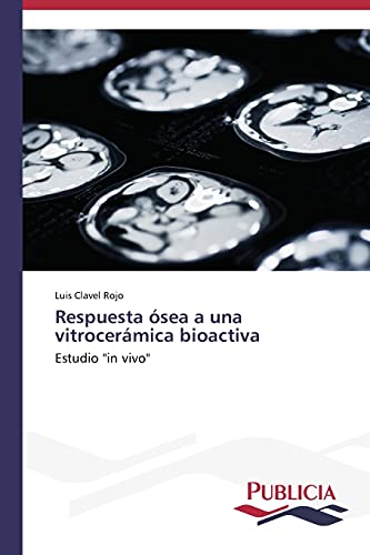 Respuesta ósea a una vitrocerámica bioactiva: Estudio in vivo