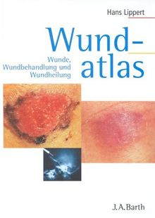 Wundatlas
