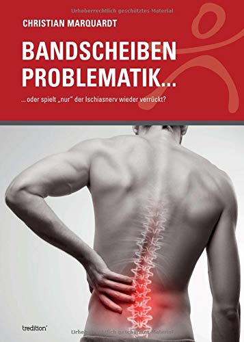 Bandscheiben Problematik: ...¿oder spielt nur der Ischiasnerv wieder verrückt?