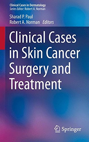 Clinical Cases in Skin Cancer Surgery and Treatment (Clinical Cases in Dermatology)