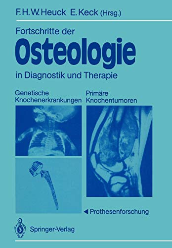 Fortschritte der Osteologie in Diagnostik und Therapie: Genetische Knochenerkrankungen Primäre Knochentumoren · Prothesenforschung Osteologia 3