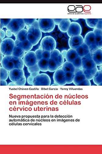 Segmentación de núcleos en imágenes de células cérvico uterinas: Nueva propuesta para la detección automática de núcleos en imágenes de células cervicales