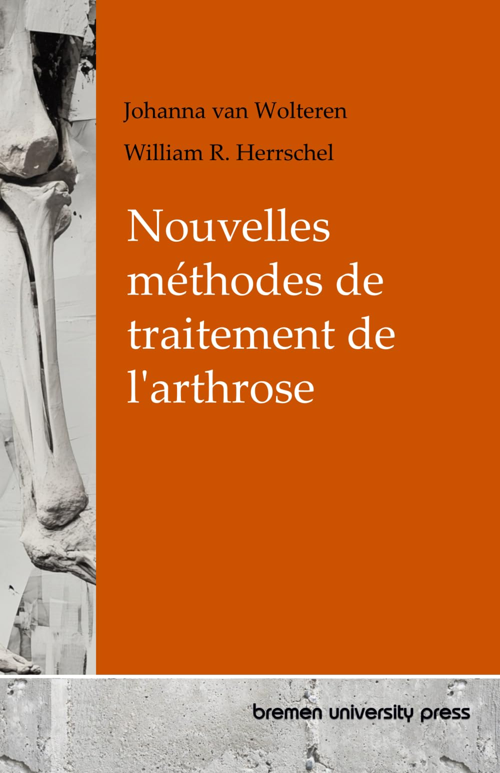 Nouvelles méthodes de traitement de l'arthrose