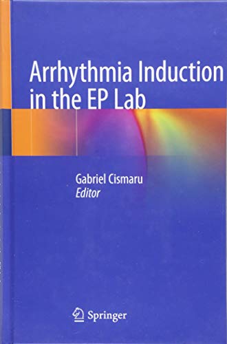 Arrhythmia Induction in the EP Lab