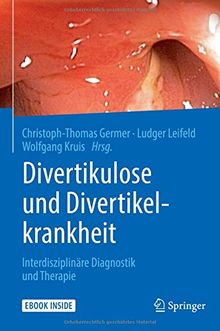 Divertikulose und Divertikelkrankheit: Interdisziplinäre Diagnostik und Therapie