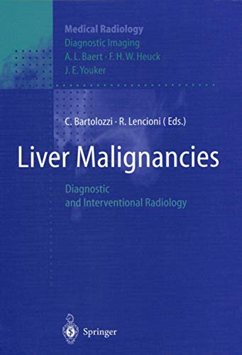 Liver Malignancies: Diagnostic and Interventional Radiology (Medical Radiology)