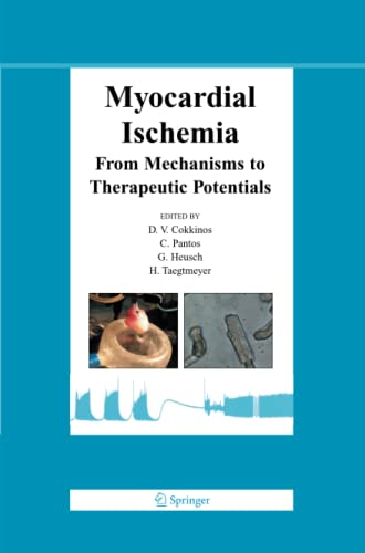 Myocardial Ischemia: From Mechanisms to Therapeutic Potentials (Basic Science for the Cardiologist, Band 21)