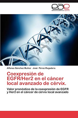 Coexpresión de EGFR/Her2 en el cáncer local avanzado de cérvix.: Valor pronóstico de la coexpresión de EGFR y Her2 en el cáncer de cérvix local avanzado