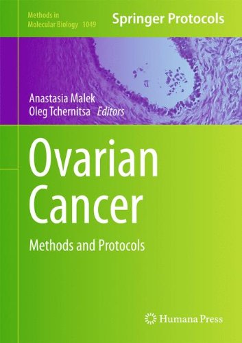 Ovarian Cancer: Methods and Protocols (Methods in Molecular Biology)