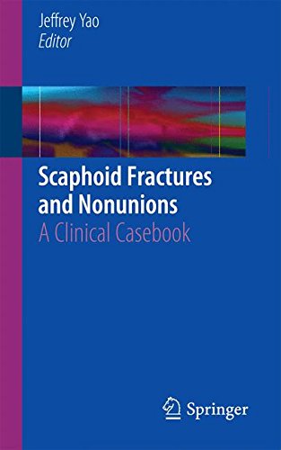 Scaphoid Fractures and Nonunions Kartoniert (TB)
