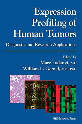 Expression Profiling of Human Tumors: Diagnostic and Research Applications