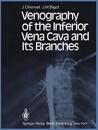 Venography of the Inferior Vena Cava and Its Branches