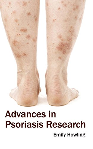 Emily Howling Advances In Psoriasis Research