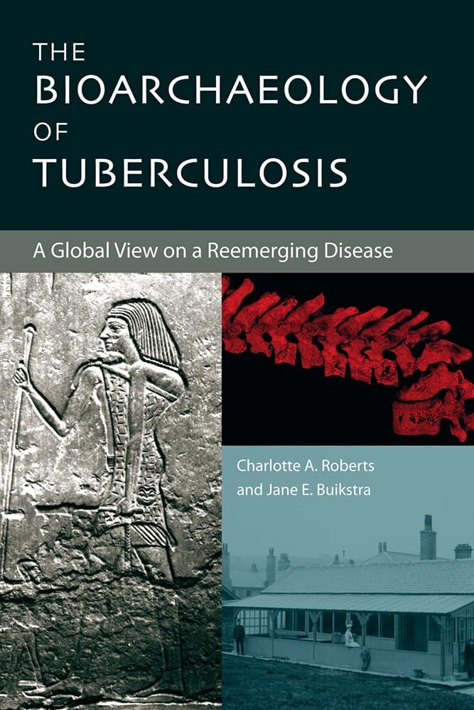 Buikstra, Jane E The Bioarchaeology Of Tuberculosis
