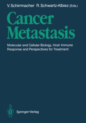 Cancer Metastasis: Molecular and Cellular Biology, Host Immune Responses and Perspective for Treatment