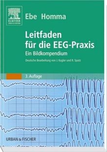 Leitfaden für die EEG-Praxis. Ein Bildkompendium