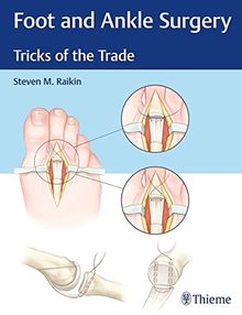 Foot and Ankle Surgery: Tricks of the Trade