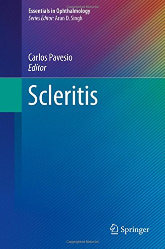 Scleritis (Essentials in Ophthalmology)