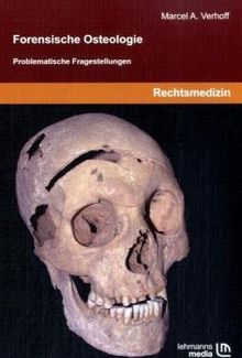 Forensische Osteologie: Problematische Fragestellungen