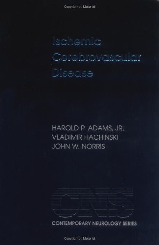 Contemporary Neurology Series